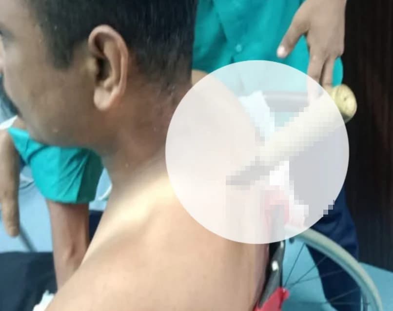 জমি নিয়ে বিবাদ নাকি অন্য কিছু? কক্সবাজারে সৌদি প্রবাসীর ওপর হামলার ঘটনায় চাঞ্চল্য