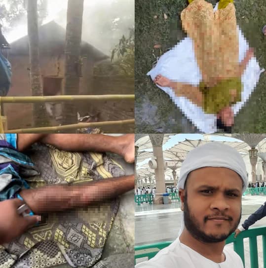 শ্রীপুরে  হাসপাতালে ঢুকে প্রবাসী ব্যবসায়ীকে পিটুনি, পা ভেঙে গৃহবধূকে শ্লীলতাহানী