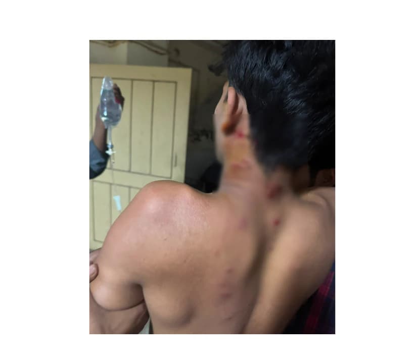 কমলনগরে ব্যবসায়ীর ওপর পরিকল্পিত হামলা,থানায় অভিযোগ