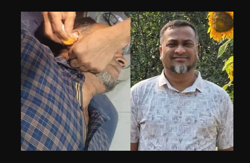 পলাশে ব্যবসায়ীকে অপহরণ করে কানে কামড়, বিএনপি নেতাসহ ১১ জনের বিরুদ্ধে মামলা