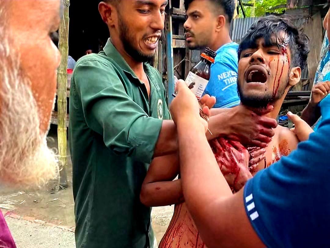 কাঁঠালিয়ায় পূর্ববিরোধের জেরে যুবকের ছুরিকাঘাত, স্থানীয়দের গণধোলাইয়ে আটক ১