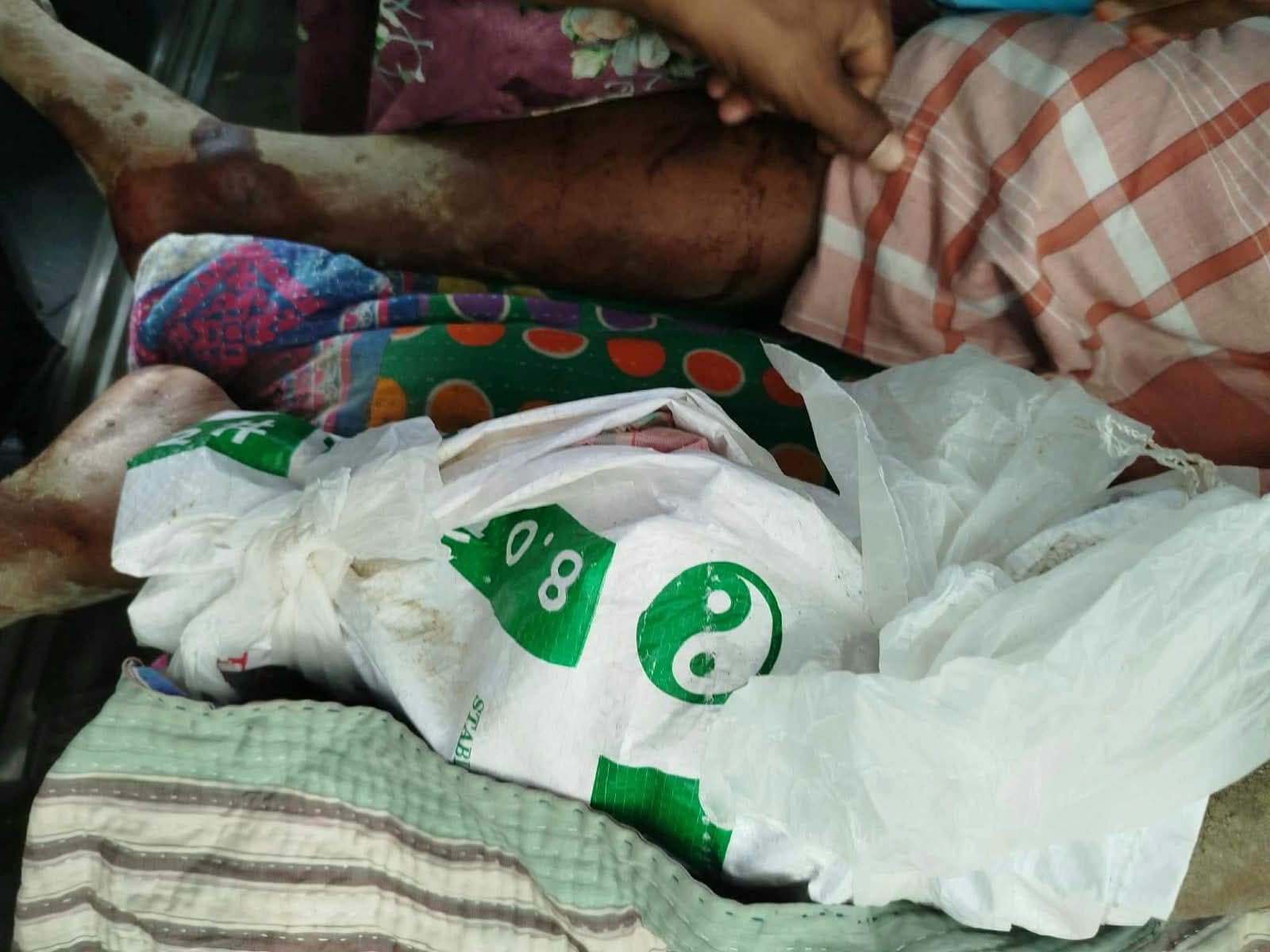 সিংড়ায় কৃষককে পিটিয়ে আহত করার অভিযোগ, রাজশাহী মেডিকেলে ভর্তি