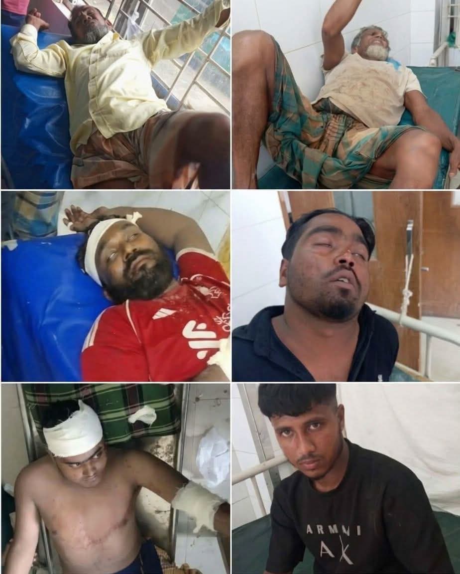 নারীদের গোসলের ছবি ধারণের অভিযোগ, বানিয়াচংয়ে দুই পক্ষের সংঘর্ষে আহত অন্তত ৫০
