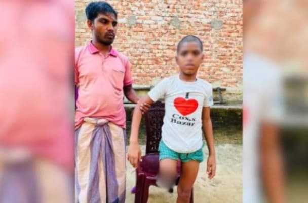 পা কেটে ভিক্ষাবৃত্তি করাতে শিশুকে পাচার, ৭ মাস পর পঙ্গু অবস্থায় বাড়ি ফিরল রায়হান।