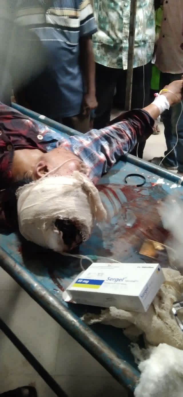 তালপল্লীতে ডাকাতের ধারালো অস্ত্রের আঘাতে রক্তাক্ত তিন পথচারী, একজনের অবস্থা আশঙ্কাজনক