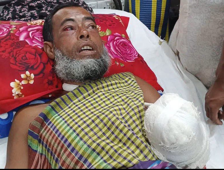 হাঁসের খামারে ডাকাতদের হামলা, খামারির হাত কেটে বিচ্ছিন্ন